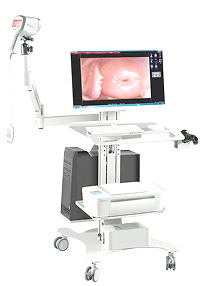 Máy soi cổ tử cung YIKEDA FULL HD 3003 1